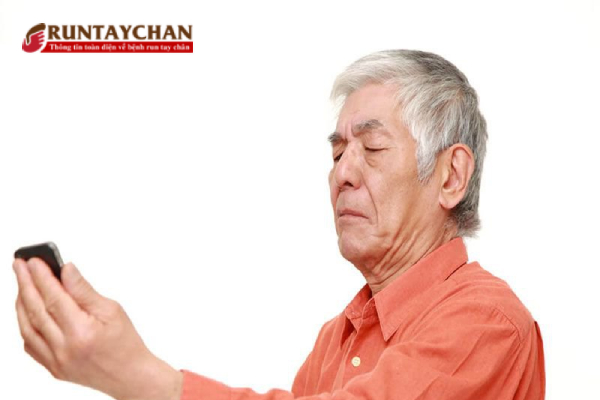 Ảo giác do rối loạn thị giác ở bệnh Parkinson làm người bệnh khó khăn trong phán đoán sự vật.